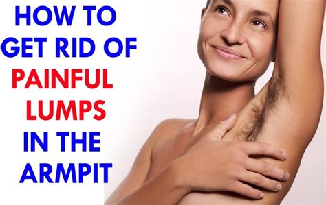 Understanding and Treating Large Painful Lumps in the Armpit: A Guide for Women - Hunter Games Magazine