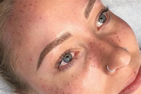 Freckle tattoos: Procedure | Aftercare | VeAn Tattoo