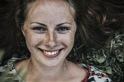 11 натурални начина за премахване на тъмните петна от кожата | Всичко ...