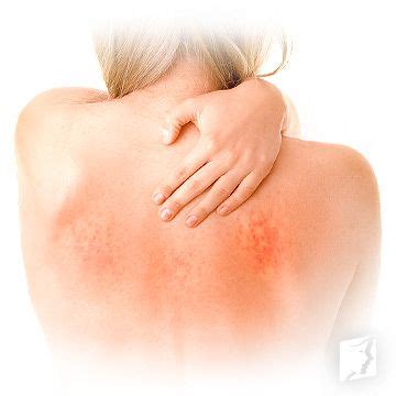 symptoms  itchy skin artofit