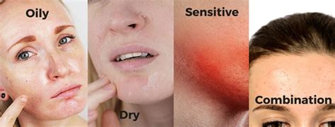 skin type    discovering   skin types london