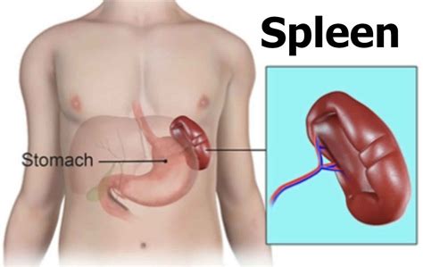 Splenectomy indications, surgery, vaccines, diet, side effects ...