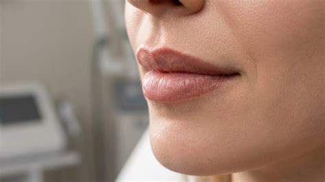 how long does masseter botox take to work