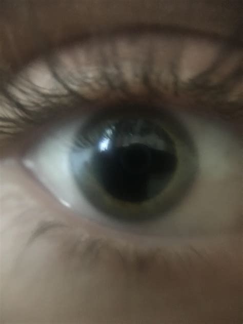 Pupils Dilated Acid