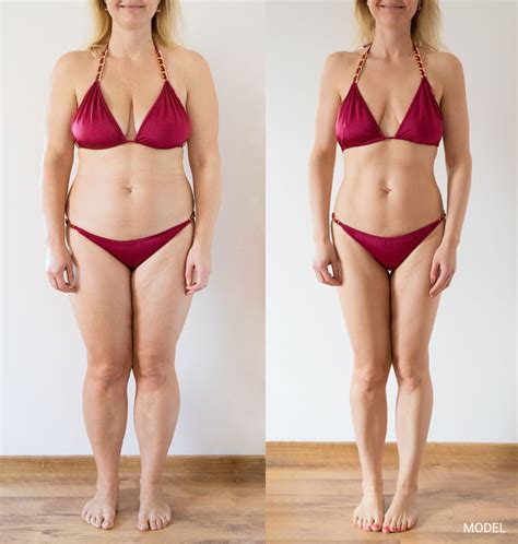 Phentermine 37.5 mg 'Diet' Weight Loss