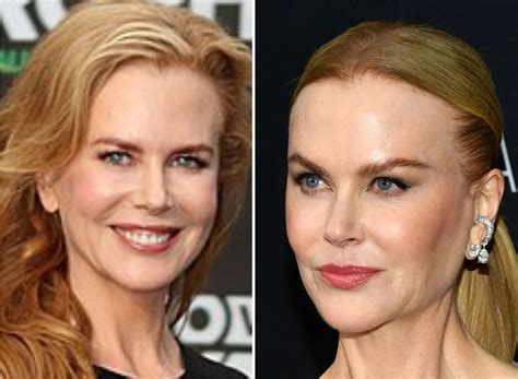 nicole kidman face