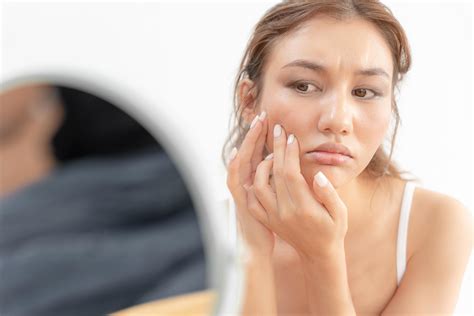 allergic reactions on the face 3