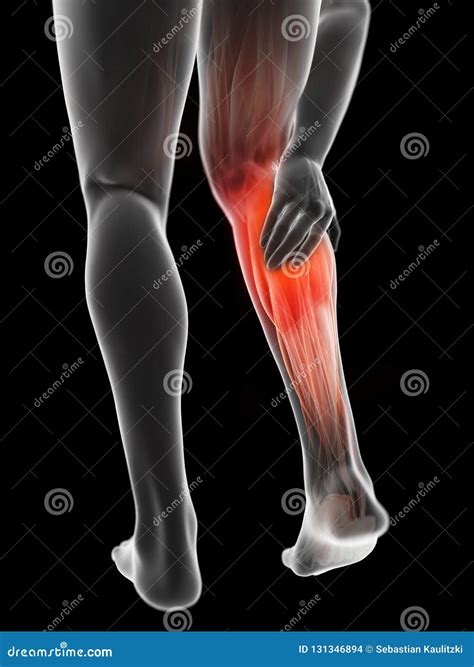 A Man Having a Painful Calf Stock Illustration - Illustration of