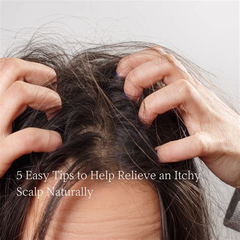 easy tips   relieve  itchy scalp naturally