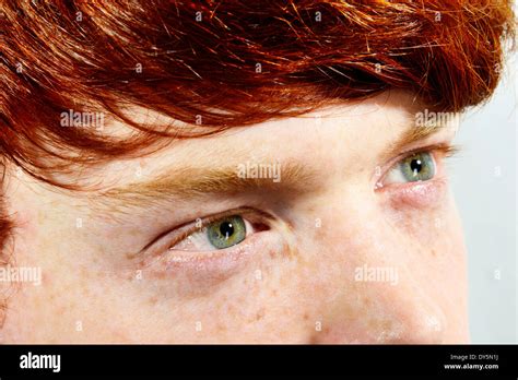 Red hair freckles facial – Telegraph