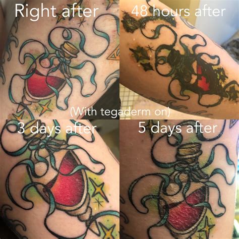 tegaderm on tattoo 7