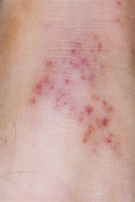red spots  skin  common