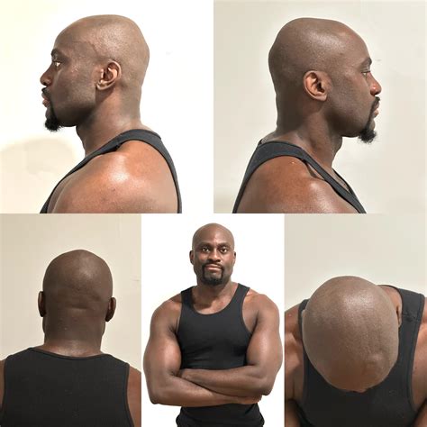 Burt Bonsu (u/lonetroper) - Reddit