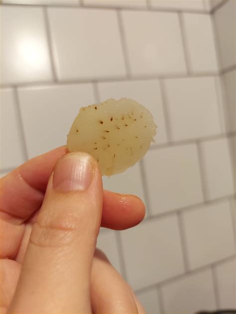 1787 best r/warts images on Pholder | Is this wart finally gone? Dont