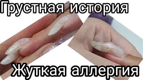 грустная история. жуткая аллергия на материал. аллергическая реакция на ...