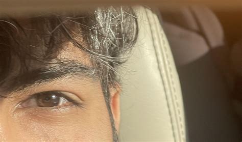Are these hunter or almond eyes? : r/Mewing