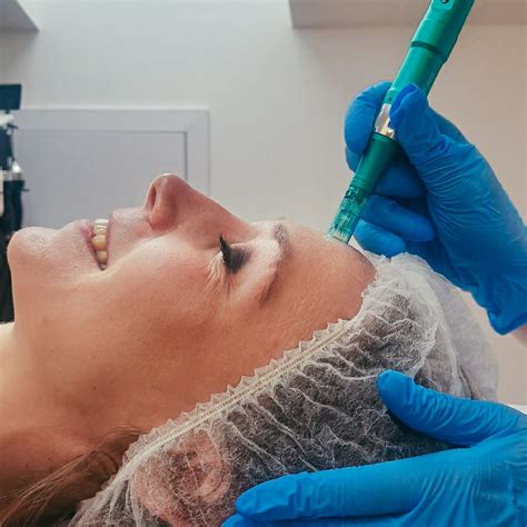 mezoterapia mikroiglowa dermapen lasermed