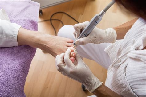 Nail Thickening (Onychauxis) at Bridget Huizenga blog