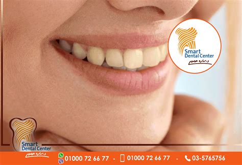 dental marketing campaign - By Huda Karam- Huda-Karam :: Tasmeem ME