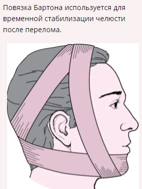 Вывих челюсти. Первая помощь