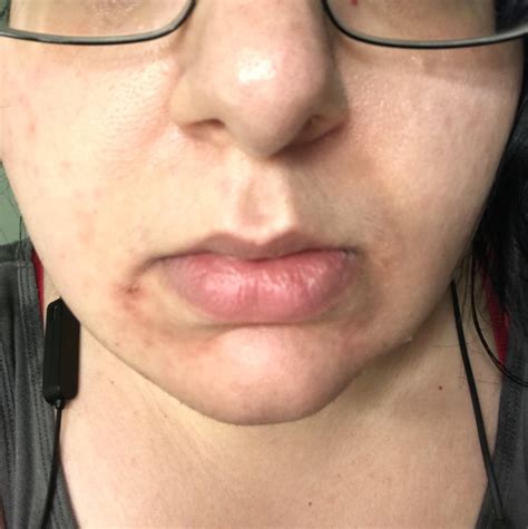 Hello, skincare addicts 👋🏻 So I just started using these two cleansers