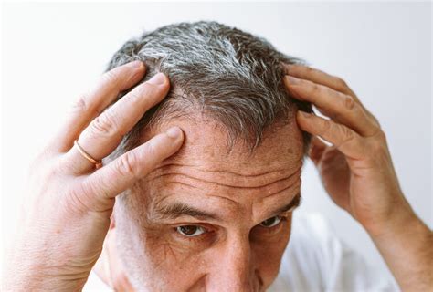 Damaged Hair in Men: Signs, Causes, Home Remedies, and More
