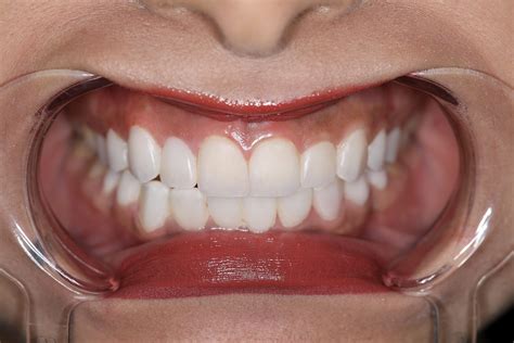 Home - Value dental