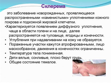 Неинфекционные заболевания кожных покровов - презентация онлайн