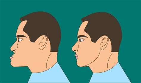 Deformed Face Illustrations, Royalty-Free Vector Graphics & Clip Art ...