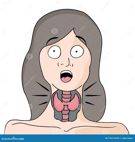 Thyroid Medical Condition Woman Cartoon Stock Vector - Illustration of