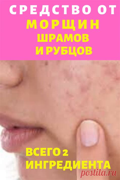 Средство от морщин шрамов и рубцов. Всего 2 ингредиента | Лучшие ...