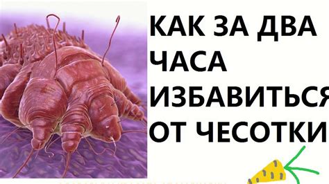 ЧЕСОТКА сделай это и через два часа чесотки не будет, рецепт - YouTube
