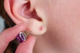 how to treat earring infection at home