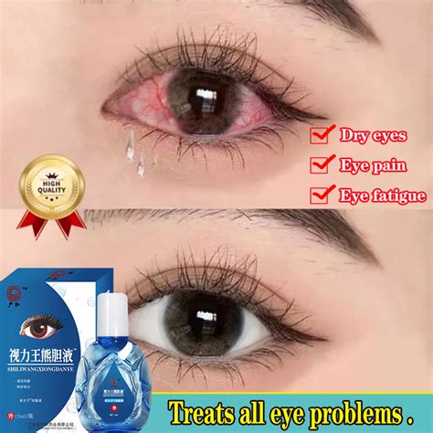 drop  effectiveeye drops  clear vision ml eye care refresh
