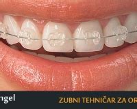Stomatološka sestra - tehničar za dentalna i intraolarna snimanja