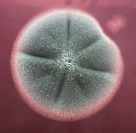 This mould spore growing on my agar looks suspiciously like a Peyote