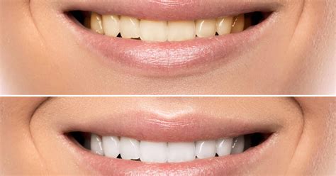 Smetti di invecchiare e inizia a sembrare più giovane - Serve solo il