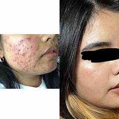 Billy Brandys Advice That Changed My Life Forever