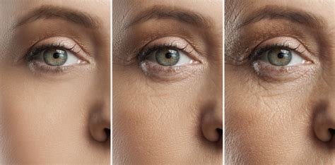 aging skin md skin lab canada