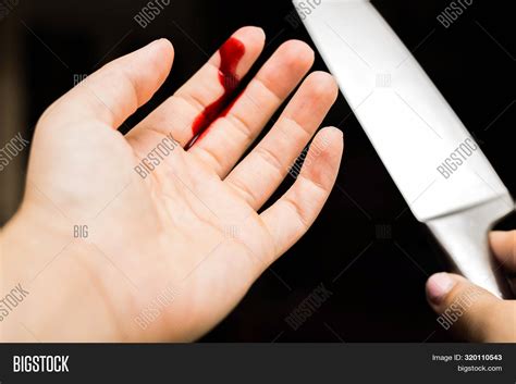 Finger Cut By Knife 