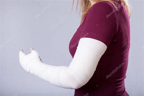 Сломанная рука стоковое фото ©photographee.eu 50982535