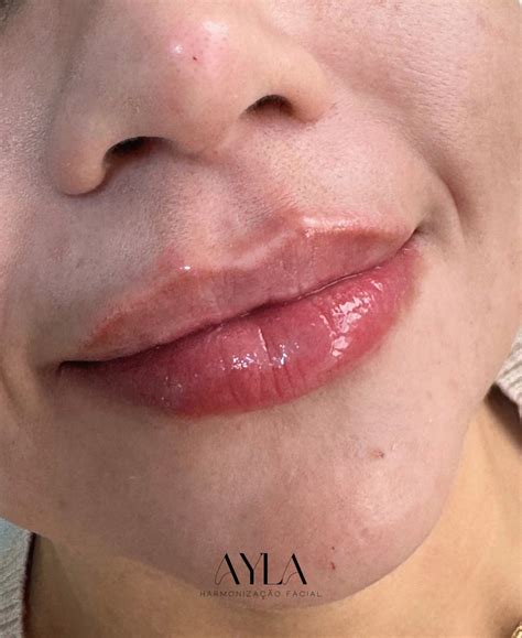 Dra. Ayla Castro (@dra.aylalcastro) • Instagram photos and videos