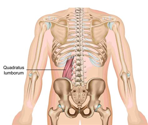 Transverse Process Fractures. A Broken Spine From Crashing