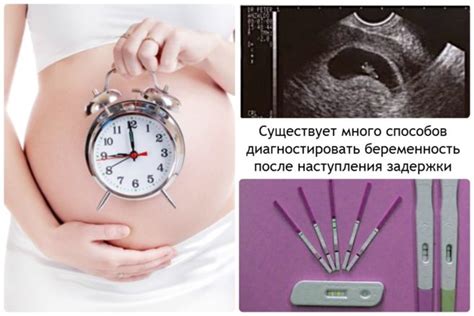 Признаки беременности - Статейный Клуб "АПП"