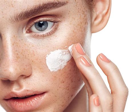 Melasma: Symptoms, Treatment & Prevention