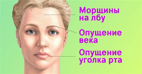 Асимметрия лица