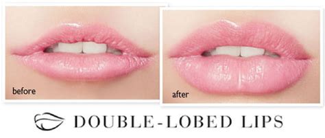 double lobed candylipz