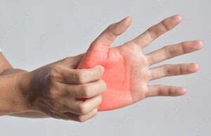 Itchy Palms: Causes, Symptoms, Treatments, Home Remedies & Prevention