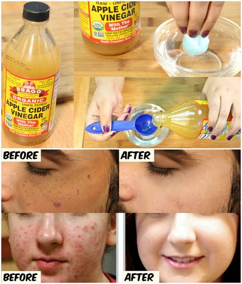 16 Most Amazing Beauty Hacks Everyone Should Know – DIY Simple Life