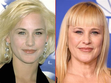 Download Actress Patricia Arquette Now And Then Wallpaper | Wallpapers.com